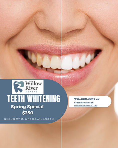 teeth whitening